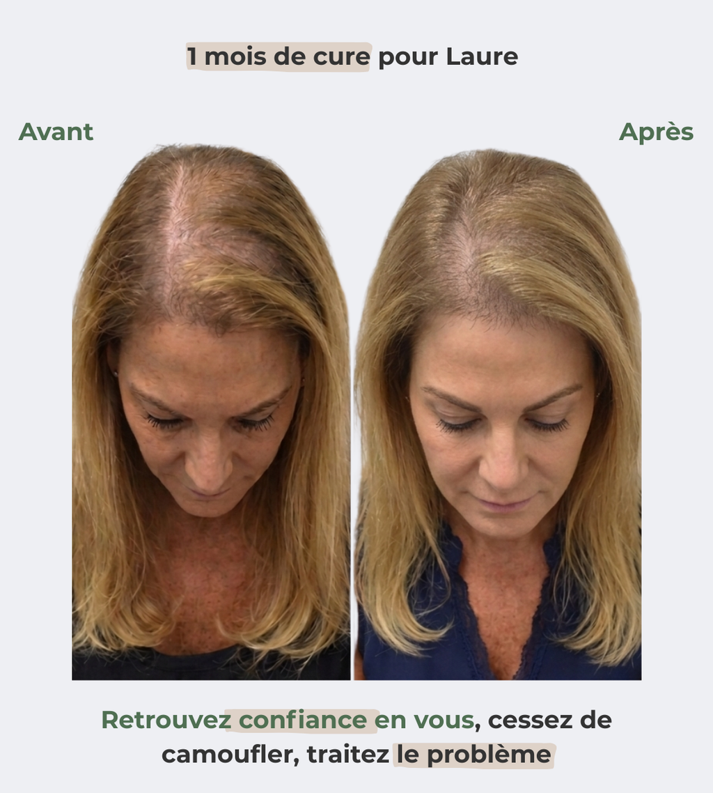 Sérum Renaissance, votre allié contre la chute hormonale