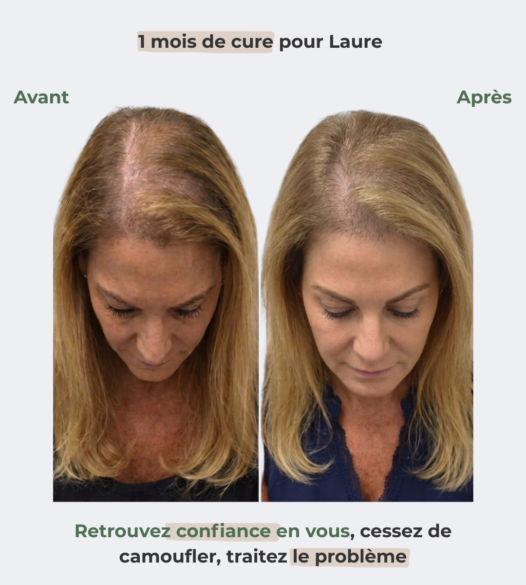 Sérum Renaissance, votre allié contre la chute hormonale