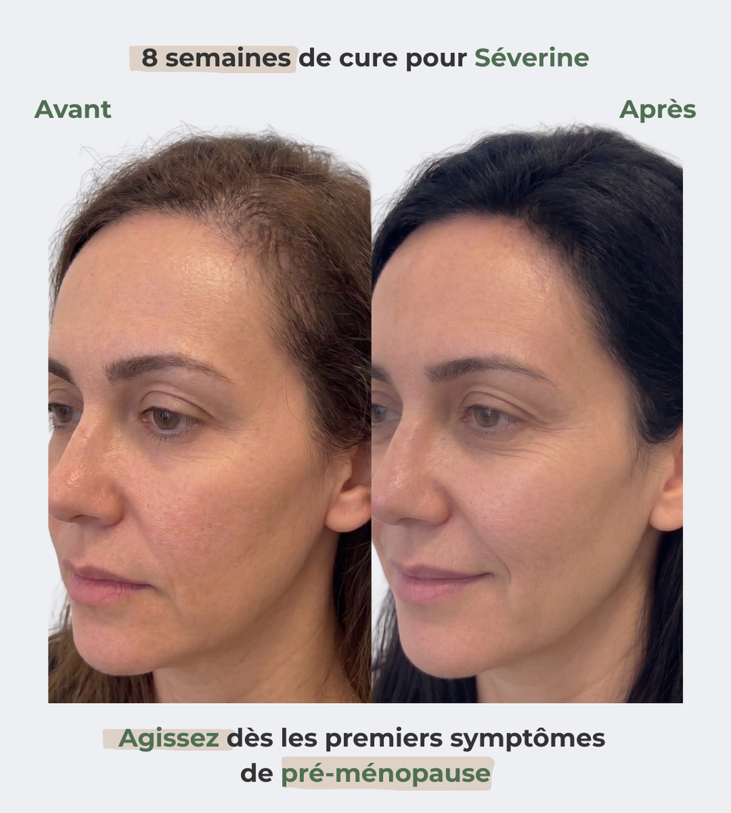 Sérum renaissance : retrouvez les cheveux de vos 20 ans