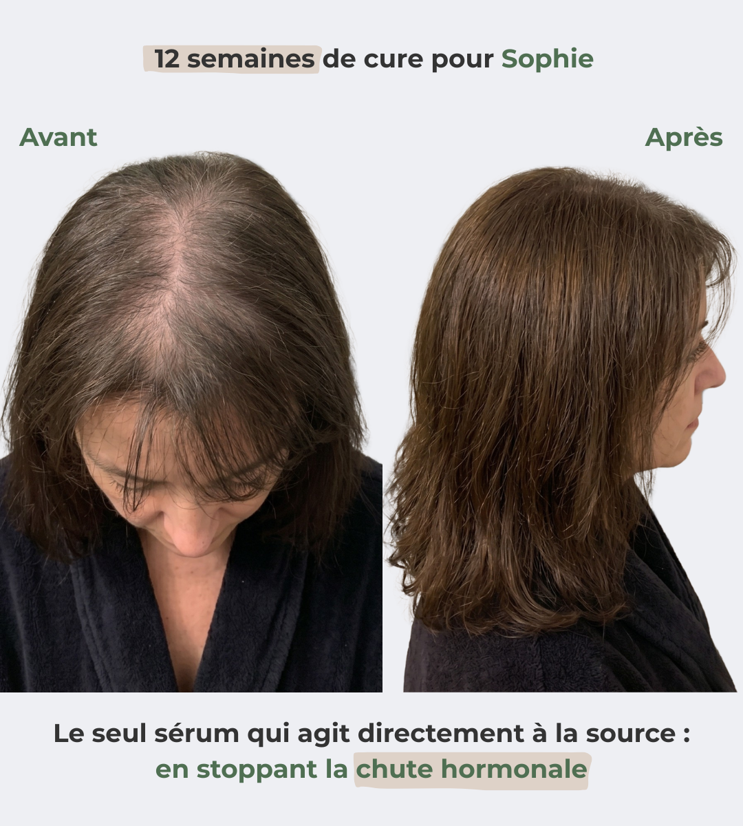 Sérum renaissance : retrouvez les cheveux de vos 20 ans