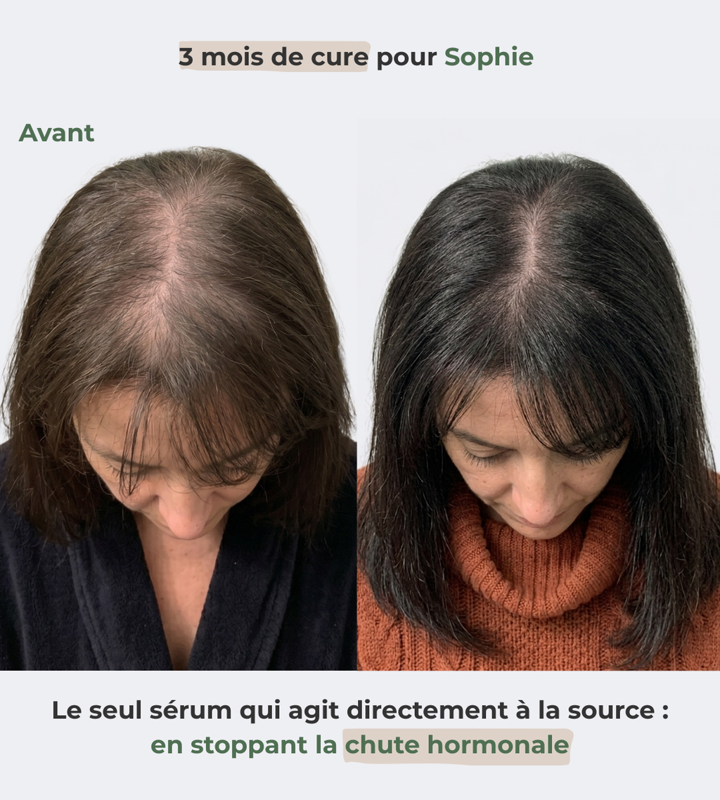 Sérum Renaissance, votre allié contre la chute hormonale