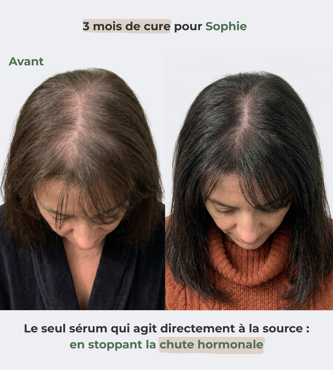 Sérum Renaissance, votre allié contre la chute hormonale