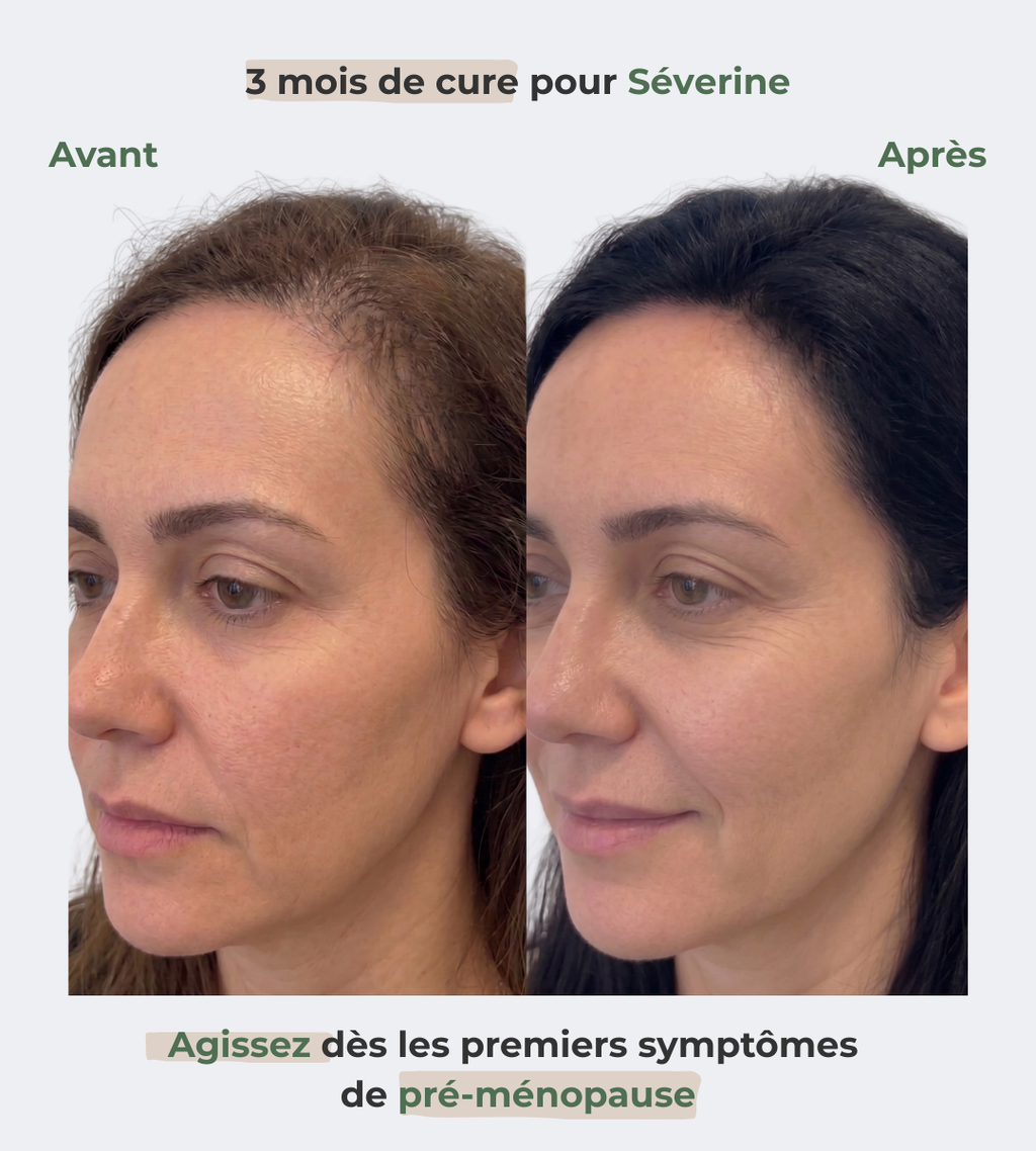 Sérum Renaissance, votre allié contre la chute hormonale