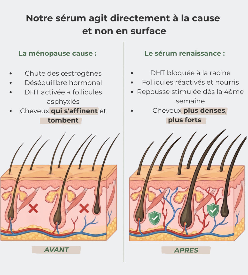 Sérum Renaissance, votre allié contre la chute hormonale