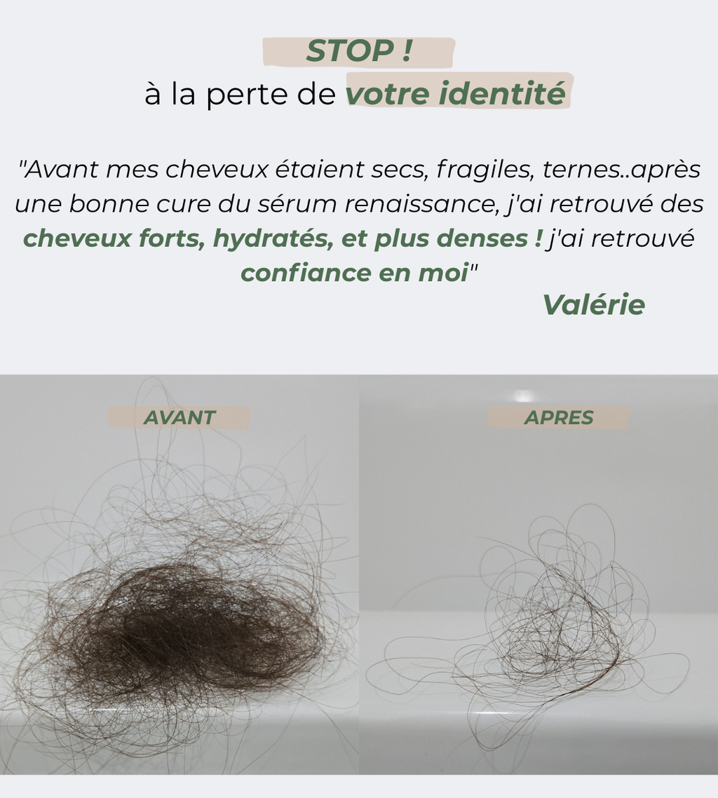 Sérum renaissance : retrouvez les cheveux de vos 20 ans